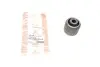 Сайлентблок рычага (переднего) BMW 3 (F30/F80/F31)/4 (F32/F82/F33/F83)/X3 (F25) 11- ASMETAL 38BM2600 (фото 1)