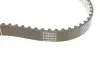 Комплект ГРМ Land Rover Discovery/Range Rover 3.0 TD 09- (20x80z) HEPU 20-2073 (фото 5)