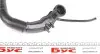 Патрубок интеркулера Renault Kangoo 1.5dCi 01- IMPERGOM 220479 (фото 3)