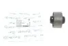Сайлентблок важеля (переднього/спереду) Hyundai Tucson/Accent/Kia Sportage 04- MEYLE 37-14 610 0006 (фото 1)